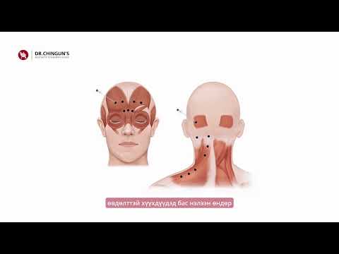 Видео: ЭМЧ ТАЙЛБАРЛАХ НЬ: 12.БОТОКС ТАРИЛГА