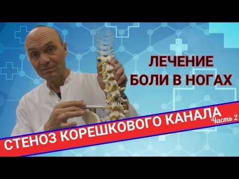 Видео: НАРАСТАЮЩАЯ БОЛЬ В НОГАХ. Стеноз корешкового канала (Часть 2)