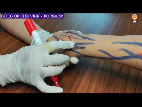 Видео: Места канюляции