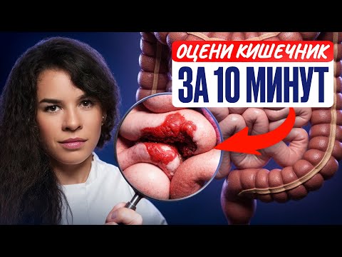 Видео: Как оценить состояние кишечника за 10 минут БЕЗ врача?