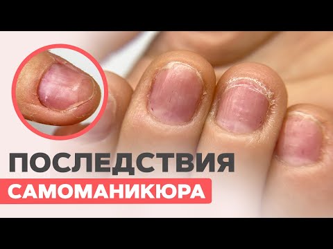 Видео: Последствия маникюра САМОЙ СЕБЕ | Укрепление система IBX