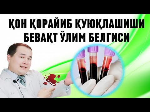 Видео: ҚОН ҚОРАЙИБ КЕТИШИ ВА ҚУЮҚЛАШИШИ САБАБЛАРИ, ҚЎЛ АЁҚ УВУШИШИ ВА БЕВАҚТ ЎЛИМ ОЛДИНИ ОЛИШ ДАВО ЧОРАЛАРИ