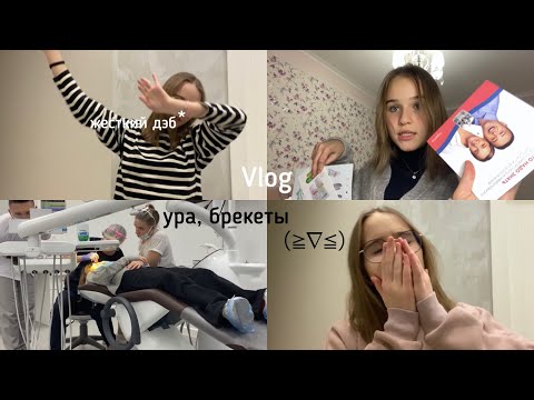 Видео: мне ставят брекеты 😲 / vlog