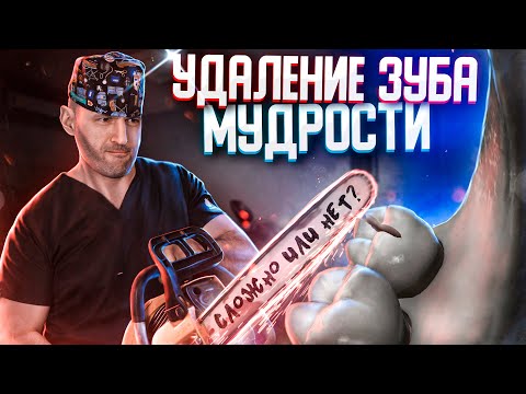 Видео: Самое понятное объяснение и  демонстрация  простого и сложного удаления зуба мудрости