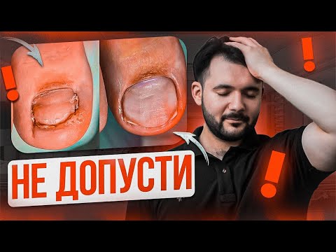 Видео: Ногти предвестники страшных болезней. ОНИ СКАЖУТ ВСЕ О ВАШЕМ ЗДОРОВЬЕ