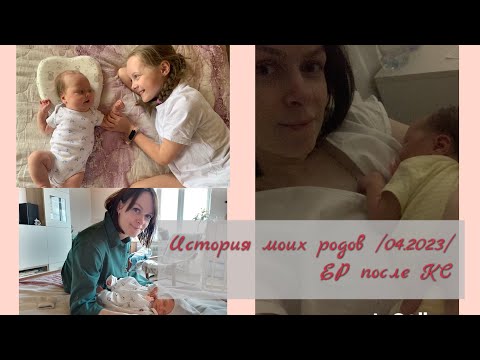Видео: История моих родов /04.2023/. Естественные роды после кесарева сечения. Роды по ОМС