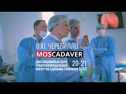 Видео: Кадавер курс для нейрохирургов "Транссфеноидальная хирургия аденомы гипофиза" В.Ю. Черебилло