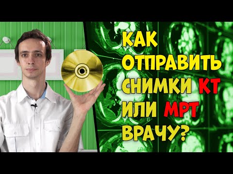 Видео: Как отправить СНИМКИ КТ или МРТ доктору 📀.