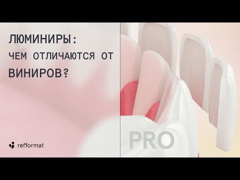 Видео: 🧐 Люминиры: чем отличаются от виниров?