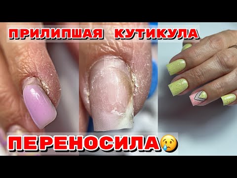 Видео: ПЕРЕНОСИЛА НОГТИ 💅 Маникюр маме 💅 Прилипшая кутикула