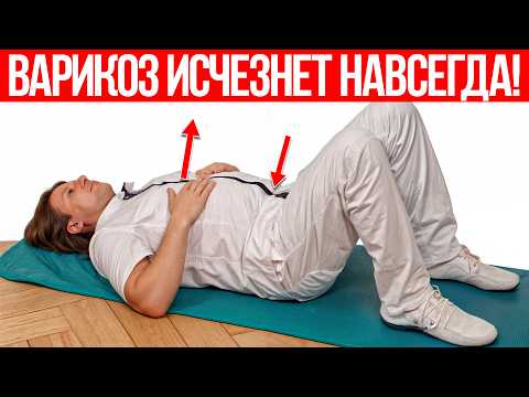Видео: Оказывается, варикоз реально лечится! Простые средства есть у каждого дома!