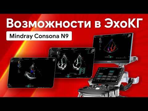 Видео: Возможности Mindray Consona N9 в эхокардиографии