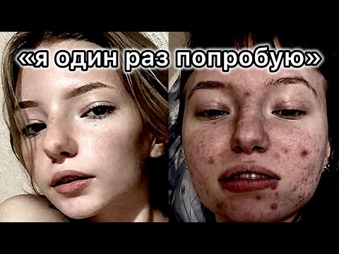 Видео: СТОРЧАЛАСЬ В 11 ЛЕТ