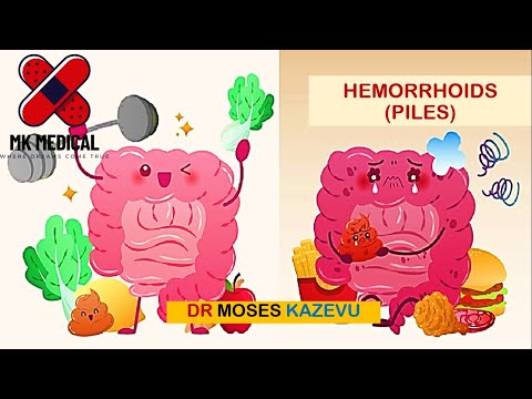 Видео: Геморрой || Геморрой