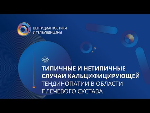 Видео: Типичные и нетипичные случаи кальцифицирующей тендинопатии в области плечевого сустава