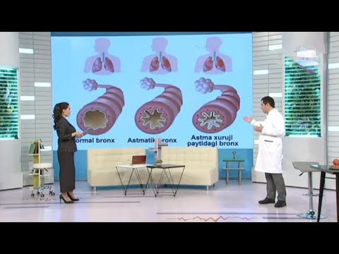 Видео: Бронхиал астма касаллиги: даволаш ва олди олиш бўйича шифокор тавсиялари | Salomatlik formulasi