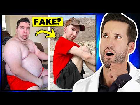 Видео: ВРАЧ смотрит на Никокадо Авокадо потеря веса