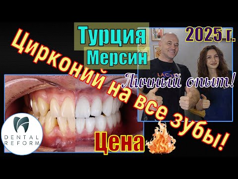 Видео: Цирконий на все зубы! По супер цене в Турции г. Мерсин! Личный опыт! 2025