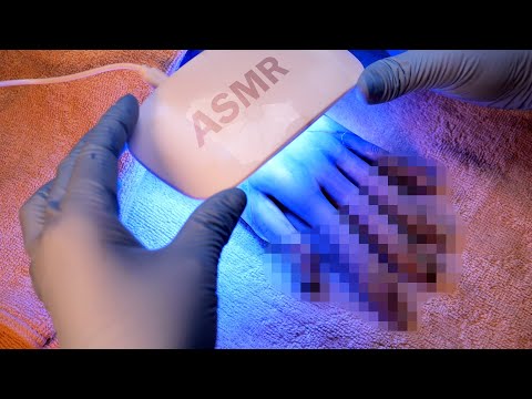 Видео: [ASMR] Результаты лечения лазером на руках... Ролевая игра (Ногти, Не говорить, ACMP)