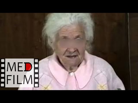 Видео: (2) Старческое слабоумие © (2) Senile dementia