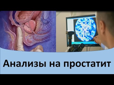 Видео: Анализы на простатит.