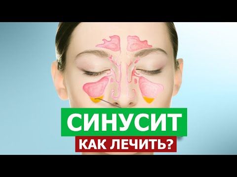 Видео: Всё о синусите ! Целитель Махачкала.