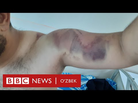 Видео: Орқамга дубинка тиқмоқчи бўлишди - Андижон милициясига даъво - Ўзбекистон BBC Uzbek
