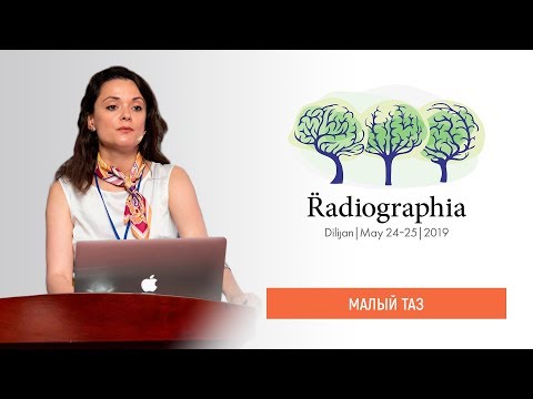 Видео: Ирина Трофименко. Малый таз — ошибки, которые   я не могу себе позволить