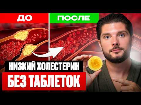 Видео: ЗАБУДЬ ПРО СТАТИНЫ! 5 шагов к нормальному холестерину без химии