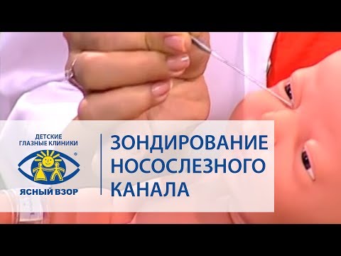 Видео: Баласанян В.О. Зондирование носослезного канала