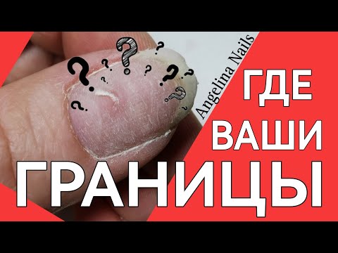 Видео: НАРАЩИВАНИЕ НОГТЕЙ / коррекция ногтей гелем / простой быстрый дизайн / здоровые границы мастера