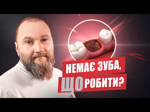 Видео: 🇺🇦 4 способа восстановить зуб