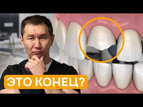Видео: Остался только корень зуба. Как восстановить?