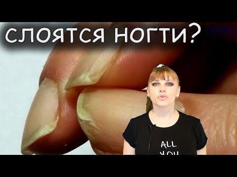 Видео: У Вас СЛОЯТСЯ НОГТИ, примените ЭТО средство? Вы этого не знали?
