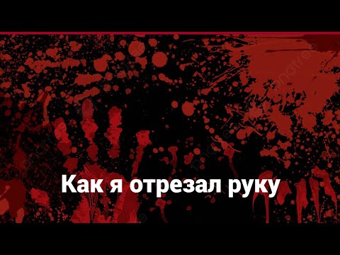 Видео: Как я отрезал руку.