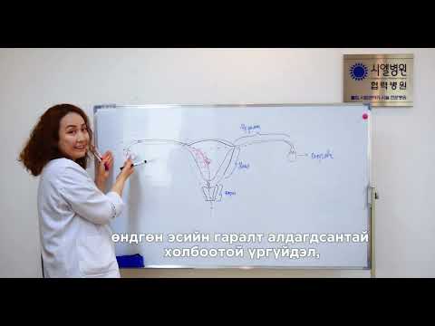 Видео: Э.Нандин-Эрдэнэ /Үргүйдэл, нөхөн үржихүйн эмч, ШУ-ы магистр/