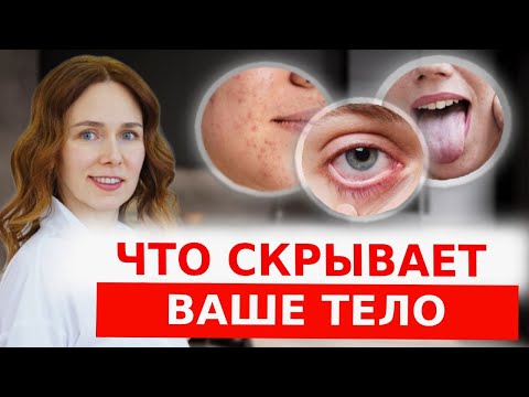 Видео: Эти симптомы НЕЛЬЗЯ игнорировать! | Проверьте себя