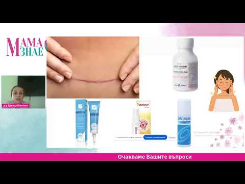 Видео: Всичко за раждането с д-р Шентова