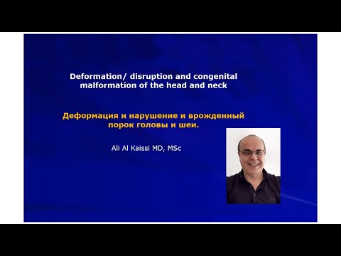 Видео: Деформации и врожденные аномалии краниоцервикального комплекса