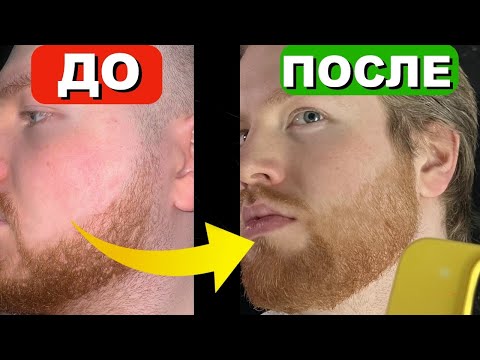 Видео: Как я отрастил Бороду