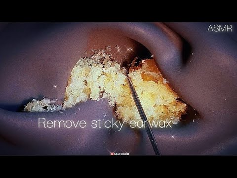 Видео: ASMR Увидев это, вы обязательно захотите прикоснуться к нему!😎 Удалите липкую ушную серу!!