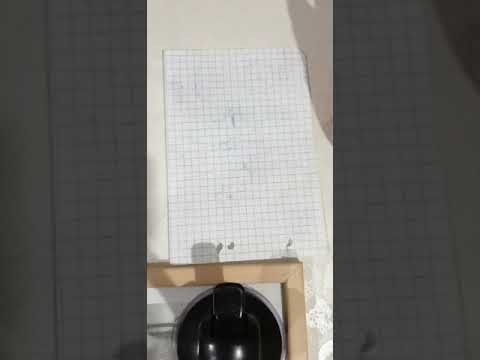 Видео: ВМД - макулодистрофия. Часть 2