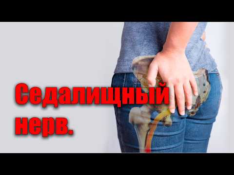 Видео: Защемило седалищный нерв. Срочно сделай эти упражнения.