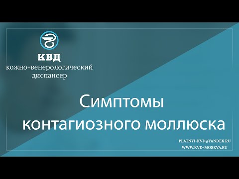 Видео: 1068  Симптомы контагиозного моллюска