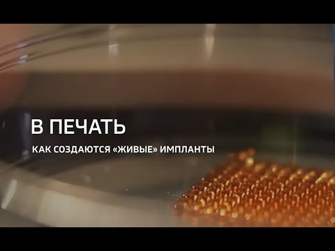 Видео: Как создаются «живые» импланты