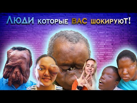 Видео: САМЫЕ НЕОБЫЧНЫЕ И СТРАННЫЕ ЛЮДИ СО ВСЕГО МИРА. Топ людей с необычной внешностью.