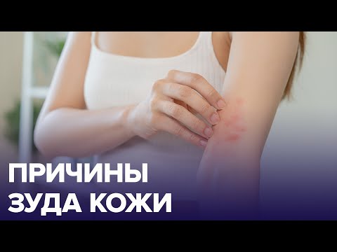 Видео: ЗУД без причины – признак дефицита витаминов | Доктор 24