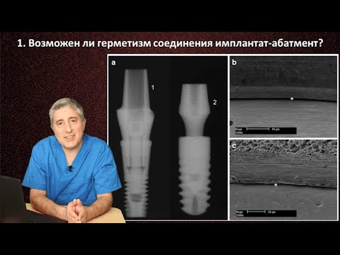 Видео: Мягкотканная интеграция имплантата (часть 4). Соединение имплантат абатмент