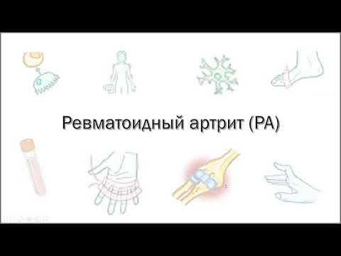 Видео: Ревматоидный артрит | определение, этиология, патогенез, клиническая картина, диагностика, лечение