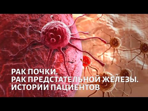 Видео: Рак почки и предстательной железы. Доктор Каприн